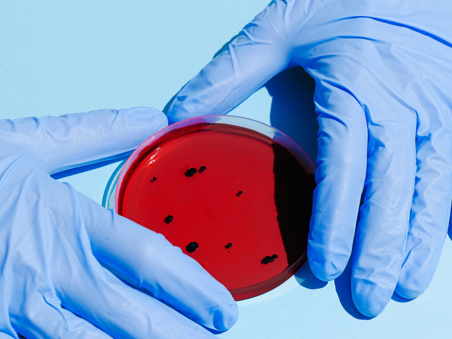 Zwei behandschuhte Hände halten eine rote Petrischale mit schwarzen Punkten auf hellblauem Untergrund.