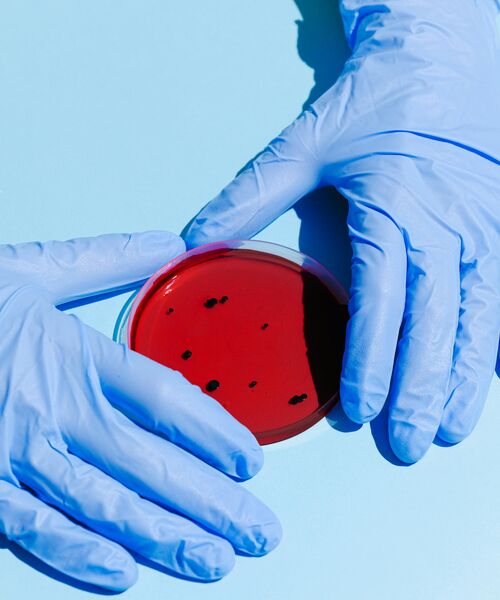 Zwei behandschuhte Hände halten eine rote Petrischale mit schwarzen Punkten auf hellblauem Untergrund.