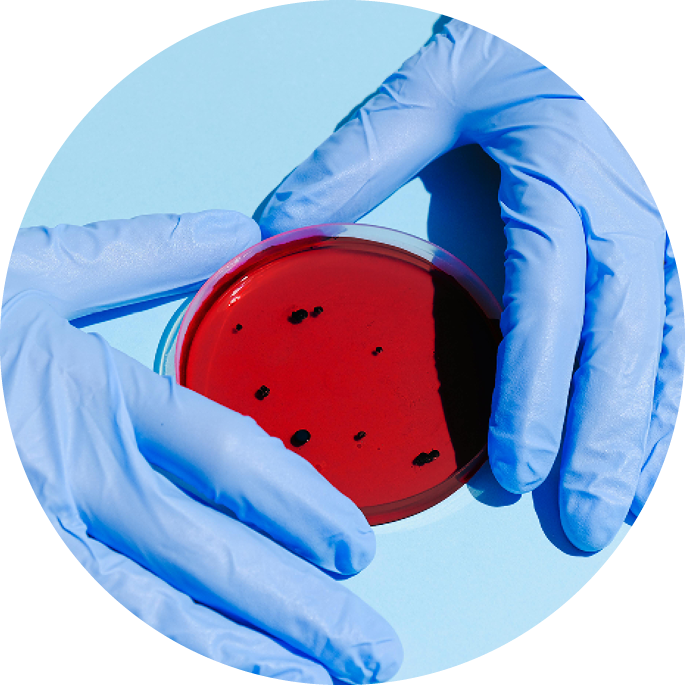 Zwei behandschuhte Hände halten eine Petrischale mit rotem Nährmedium und schwarzen Punkten auf hellblauem Hintergrund.